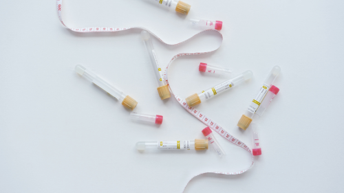 Д-р Васил Бранков: За инвитро процедурите най-важно е спокойствието