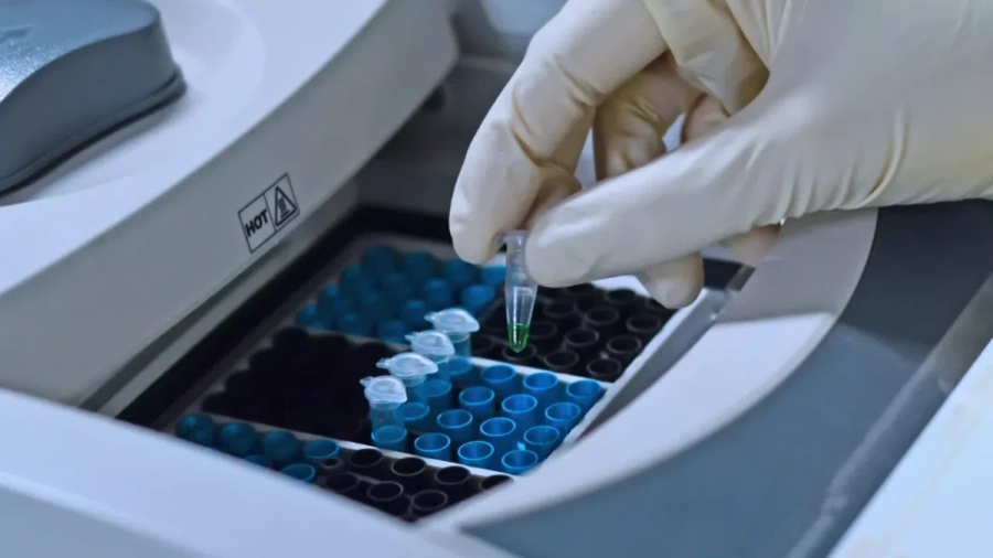 Варна и Пловдив ще имат модерни лаборатории за PCR диагностика