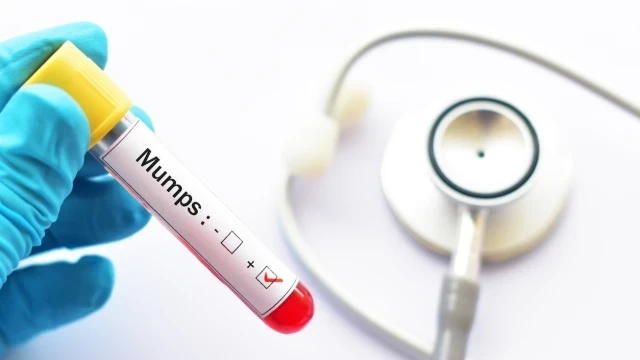 Нови случаи на заразени с морбили в областите Враца и Плевен