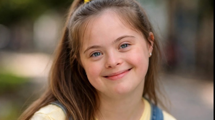 Пробив: Неутрализираха генетична причина за Синдрома на Даун