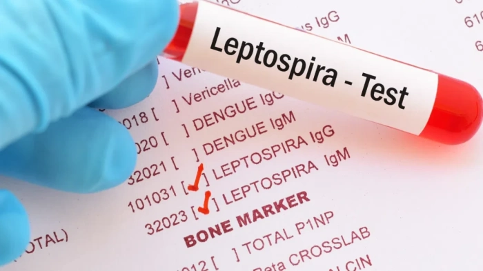 Случаи на заразени с лептоспироза на остров Закинтос